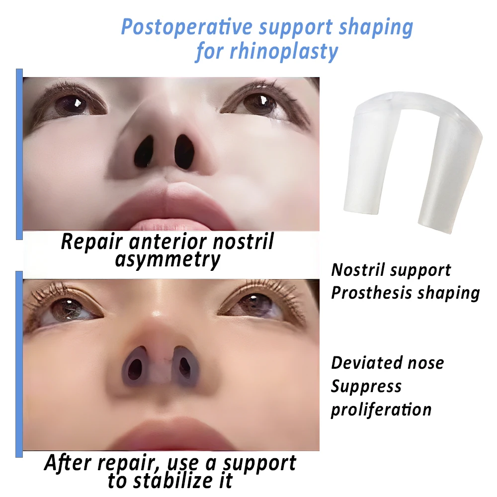 Postoperatieve Neuscorrectie N - Anti Snore Contour Pillow recensie en prijs